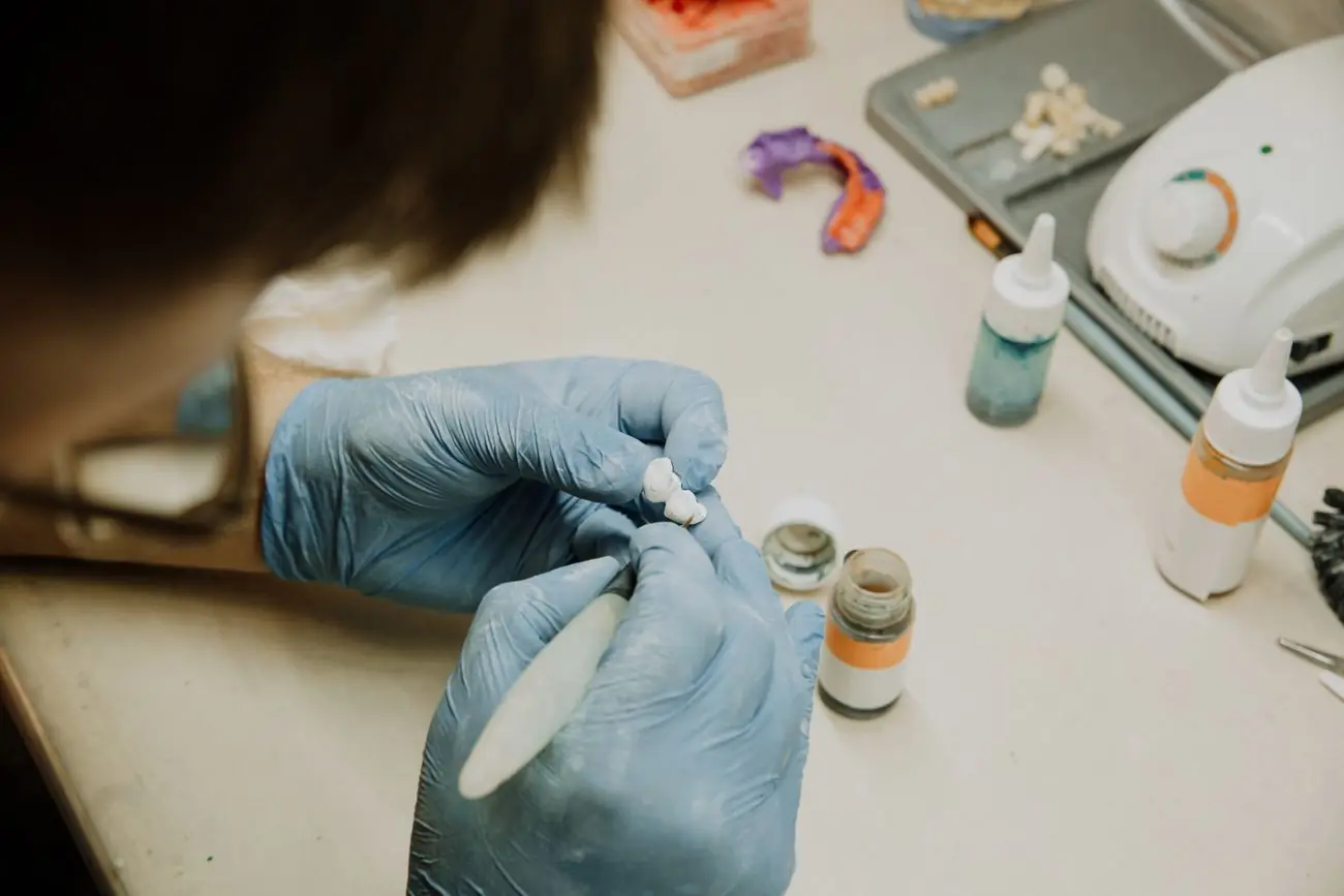 Técnica de luvas azuis ajustando um dente de prótese, com frascos de insumo ao lado